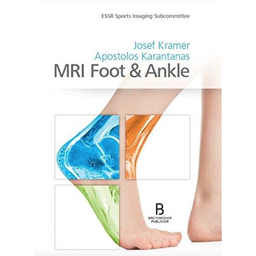 MRI Foot & Ankle