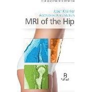 MRI of the Hip