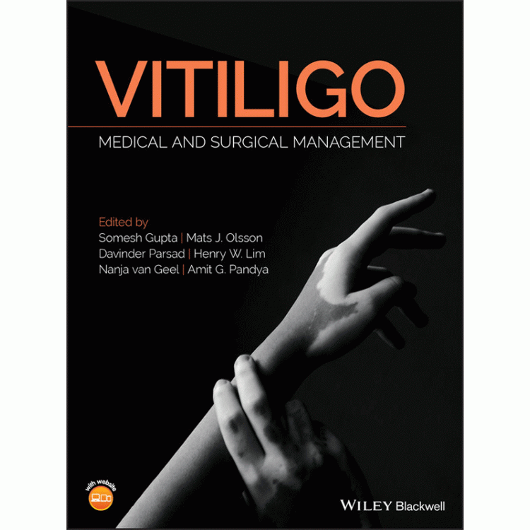 Vitiligo: Medical and Surgical Management