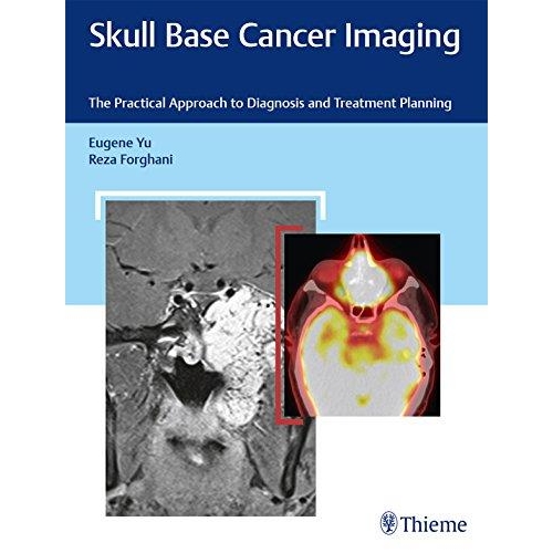 Skull Base Cancer Imaging The Practical Approach to Diagnosis and Treatment Planning