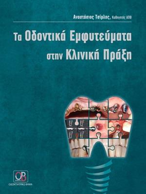 Τα Οδοντικά Εμφυτεύματα στην Κλινική Πράξη