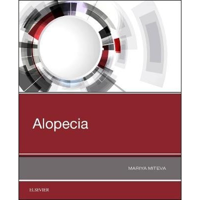 Alopecia, 1st Edition
