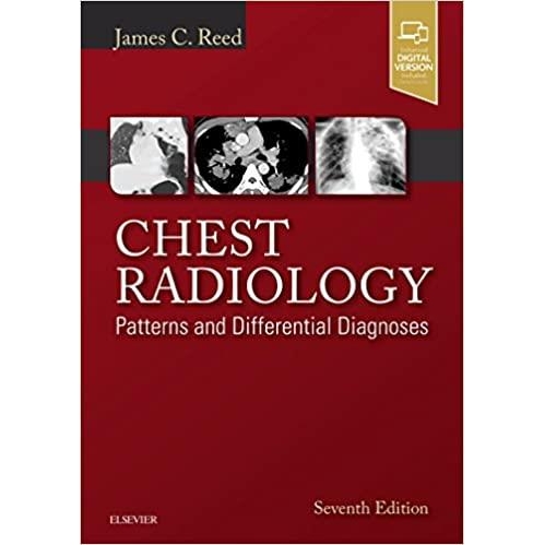 Chest Radiology, 7th Edition