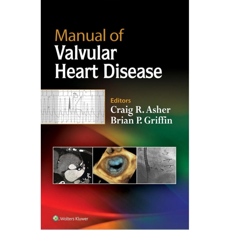 Manual of Valvular Heart Disease