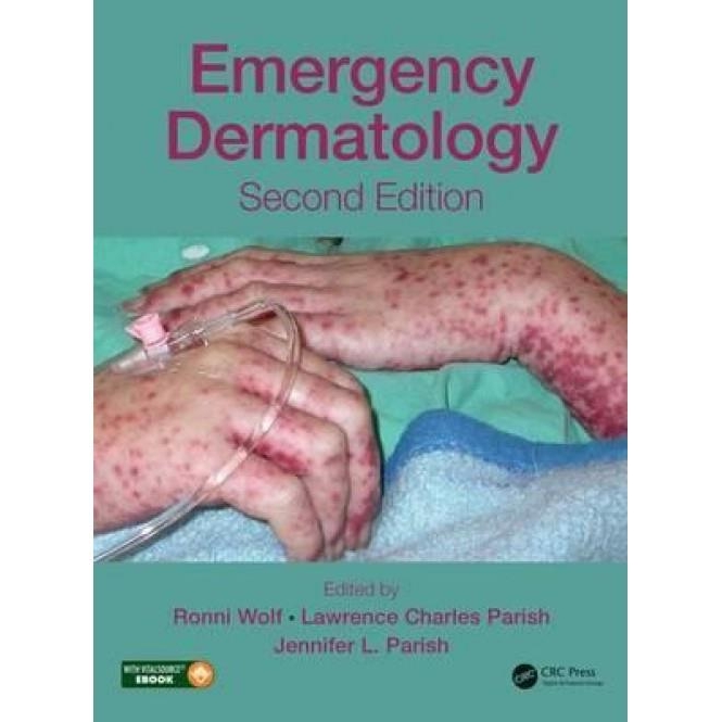 Emergency Dermatology, 2nd Edition