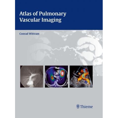 Atlas of Pulmonary Vascular Imaging