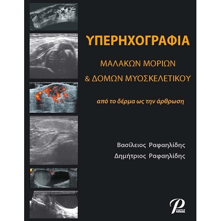 Υπερηχογραφία Μαλακών Μορίων & Δομών Μυοσκελετικού