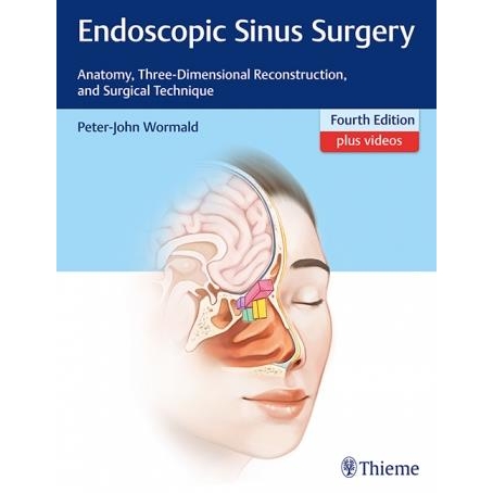 Endoscopic Sinus Surgery 4th edition