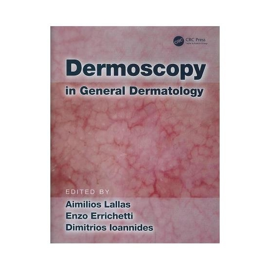 Dermoscopy in General Dermatology, 1st Edition