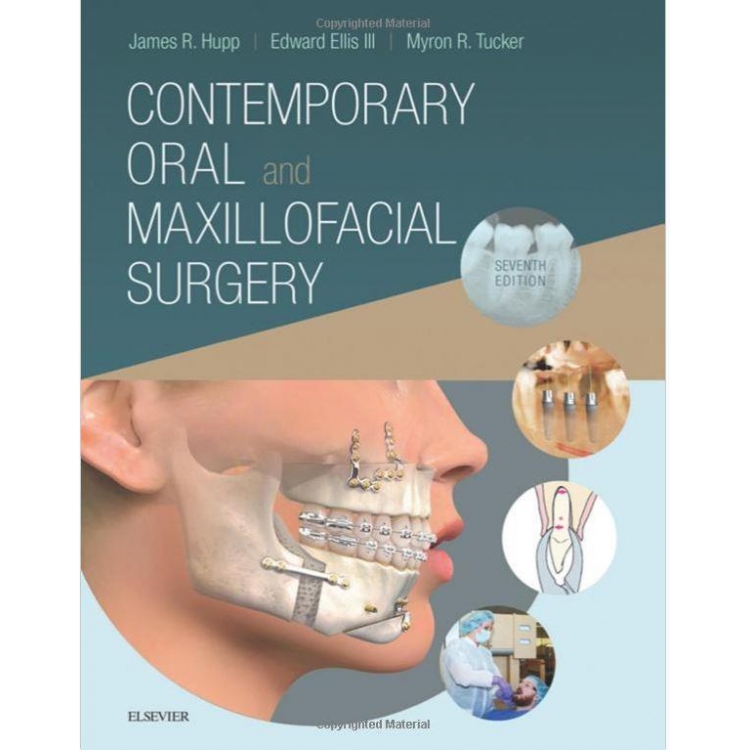Contemporary Oral and Maxillofacial Surgery, 7th Edition