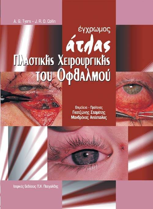 Έγχρωμος Άτλας Πλαστικής Χειρουργικής του Οφθαλμού