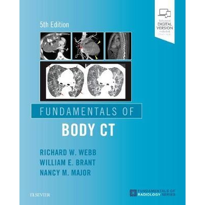 Fundamentals of Body CT, 5th Edition