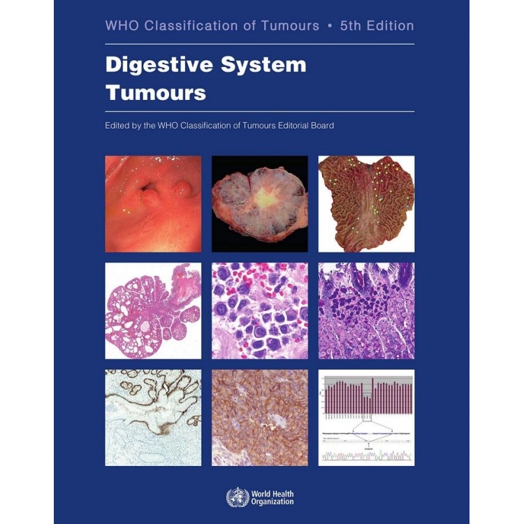 WHO Classification of Tumours: Digestive System Tumours, 5th Edition