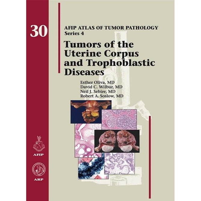 Tumors of the Uterine Corpus and Trophoblastic Diseases