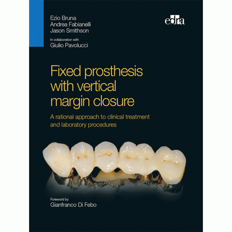Fixed prosthesis with vertical margin closure. A rational approach to clinical treatment and laboratory procedures