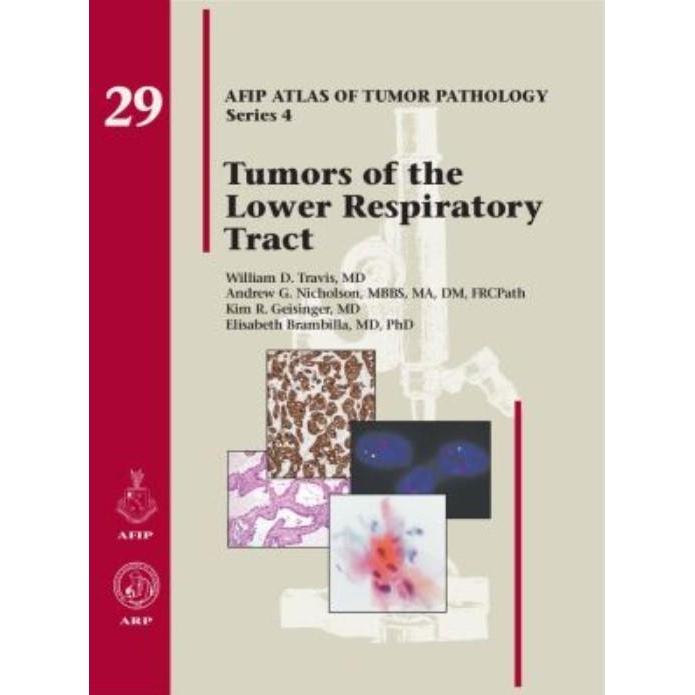 Tumors of the Lower Respiratory Tract