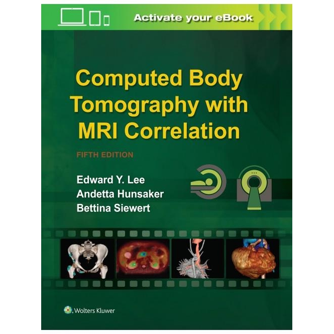 Computed Body Tomography with MRI Correlation. 5th Edition