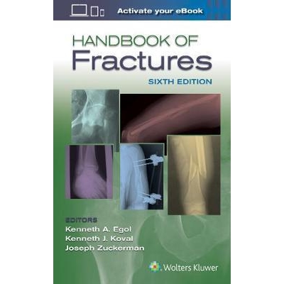 Handbook of Fractures, 6th Edition