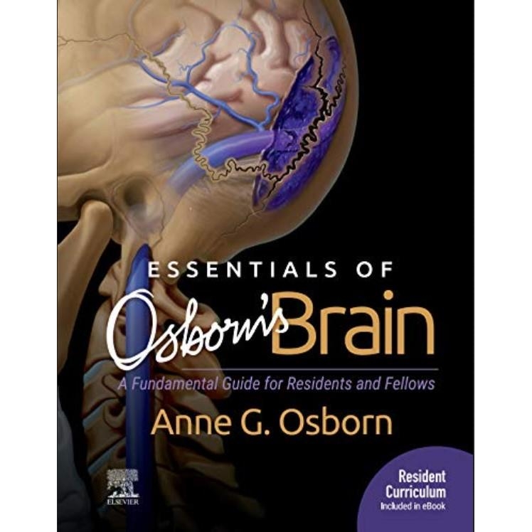 Essentials of Osborn`s Brain
