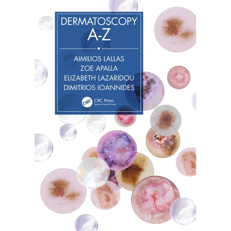 Dermatoscopy A-Z