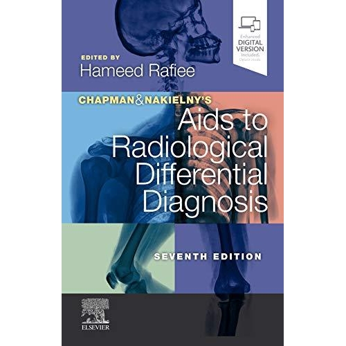 Chapman & Nakielny`s Aids to Radiological Differential Diagnosis, 7th Edition