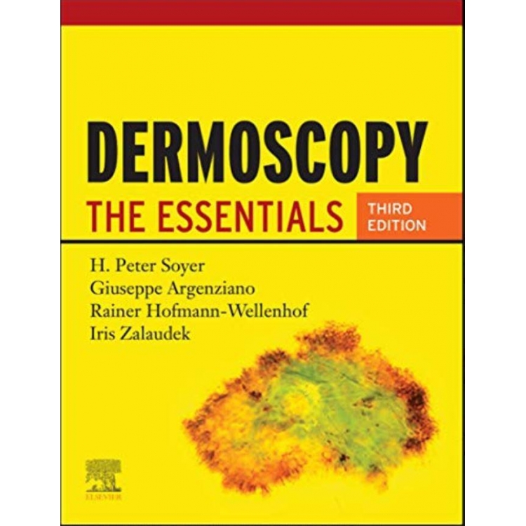 Dermoscopy The Essentials 3rd Edition