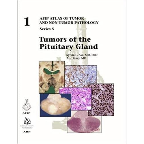 Tumors of the Pituitary Gland
