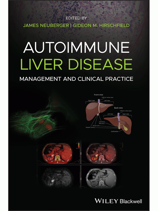 Autoimmune Liver Disease: Management and Clinical Practice