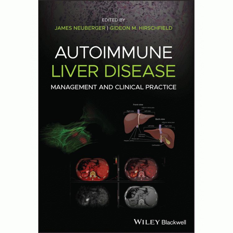 Autoimmune Liver Disease: Management and Clinical Practice