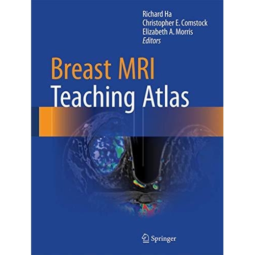 Breast MRI Teaching Atlas