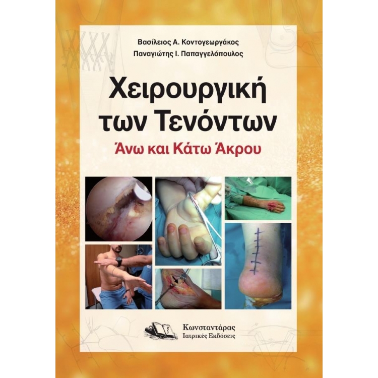 Χειρουργική των Τενόντων Άνω και Κάτω Άκρου