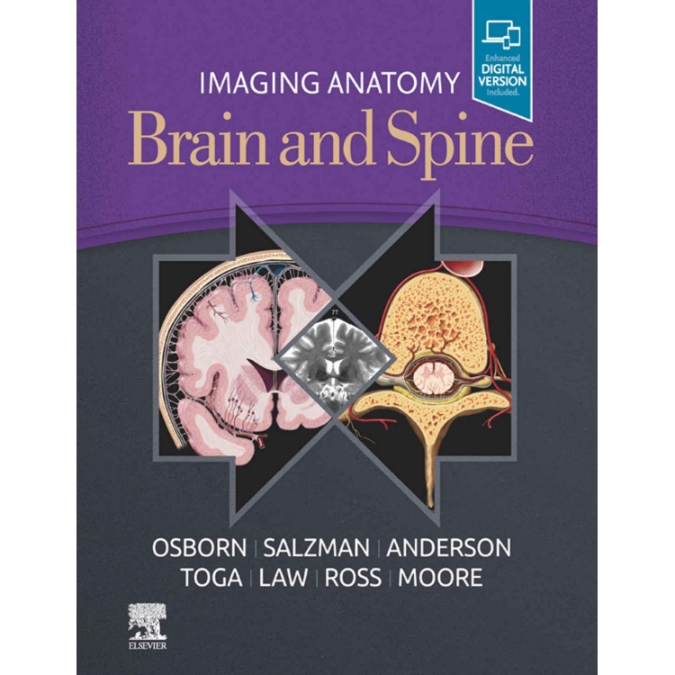 Imaging Anatomy Brain and Spine