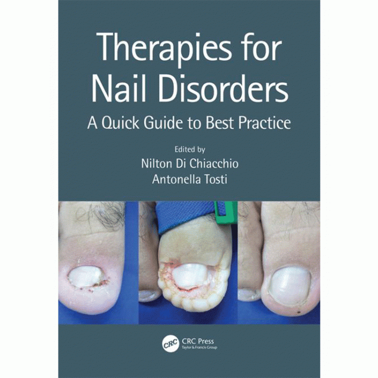 Therapies for Nail Disorders: A Quick Guide to Best Practice, 1st Edition