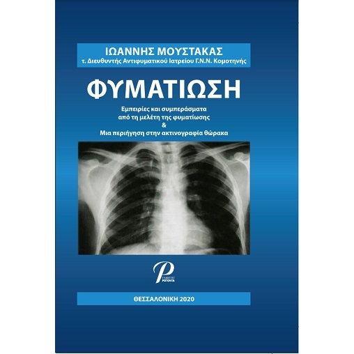 Φυματίωση