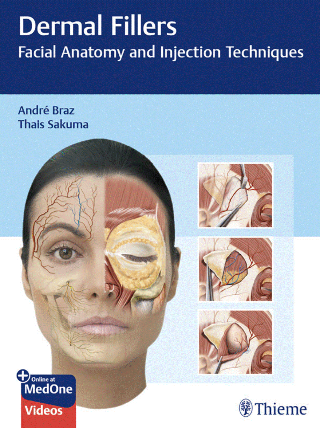 Dermal Fillers: Facial Anatomy and Injection Techniques, 1st Edition