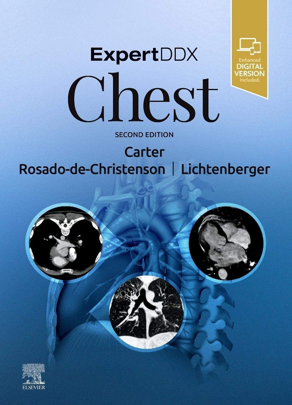 ExpertDDx: Chest, 2nd Edition