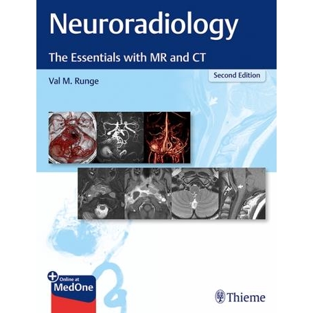 Neuroradiology: The Essentials with MR and CT, 2nd Edition