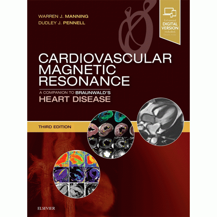 Cardiovascular Magnetic Resonance, 3rd Edition