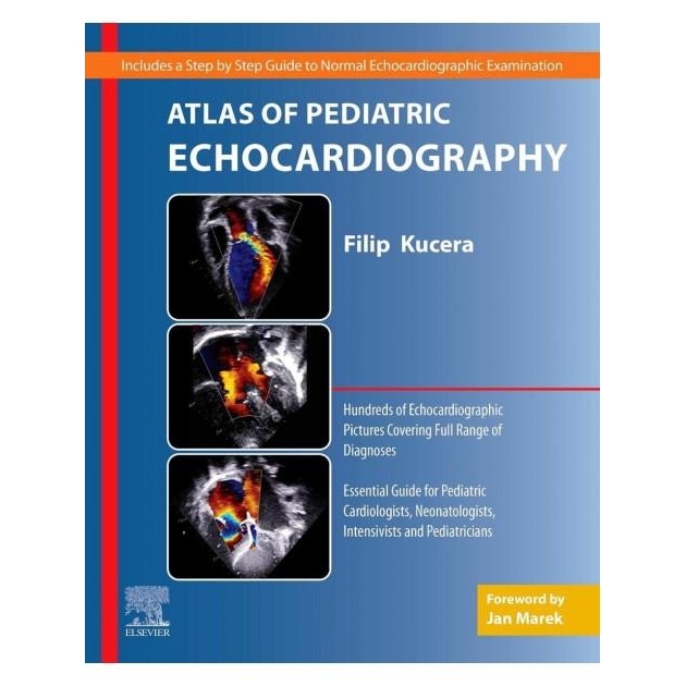 Atlas of Pediatric Echocardiography