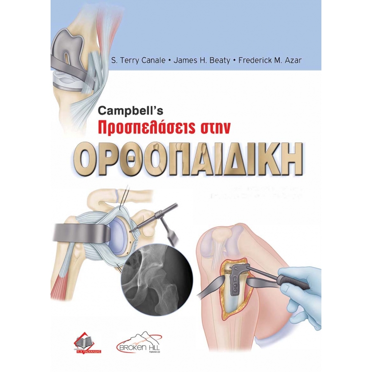 Campbell`s Προσπελάσεις στην Ορθοπαιδική, 1η Έκδοση