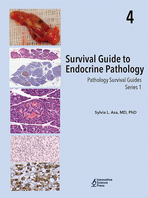 Survival Guide to Endocrine Pathology