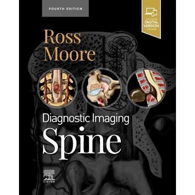 Diagnostic Imaging: Spine, 4th Edition