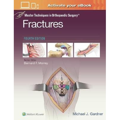 Master Techniques in Orthopaedic Surgery Fractures, 4th edition