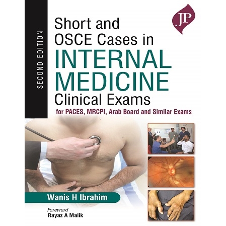Short and OSCE Cases in Internal Medicine: Clinical Exams for PACES, MRCPI, Arab Board and Similar Exams