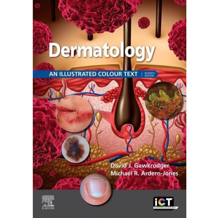 Dermatology: An Illustrated Colour Text, 7th Edition