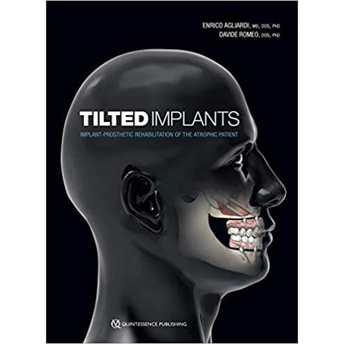 Tilted Implants (Implant-Prosethetic Rehabilitation of the Atrophic Patient)