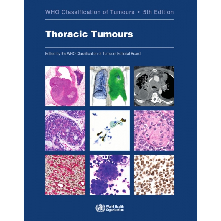 WHO Classification of Tumours Thoracic Tumours, 5th Edition