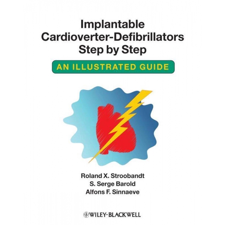 Implantable Cardioverter-Defibrillators Step by Step: An Illustrated Guide