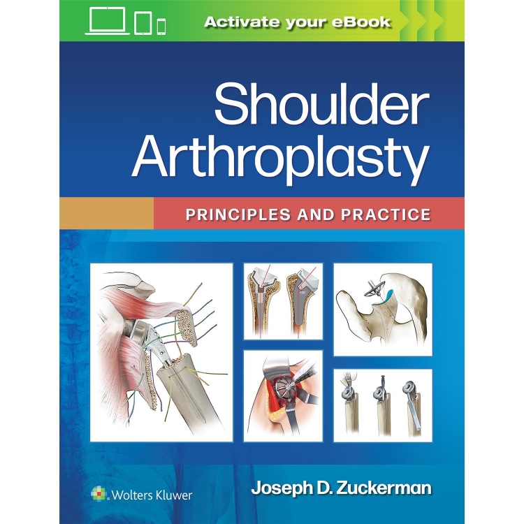Shoulder Arthroplasty Principles and Practice, First edition