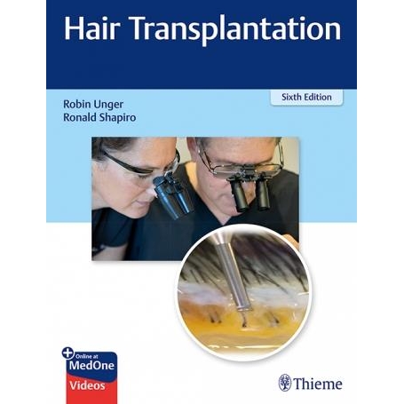 Hair Transplantation 6e